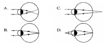 section-media